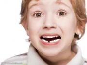 兒童乳牙的重要性