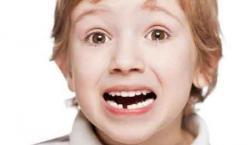 兒童乳牙的重要性